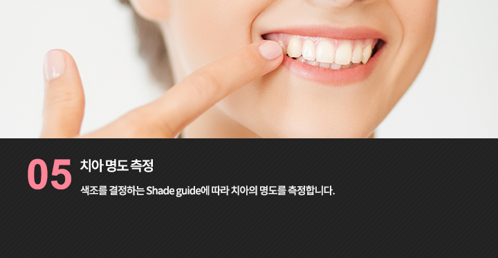 색조를 결정하는 Shade guide에 따라 치아의 명도를 측정합니다. 